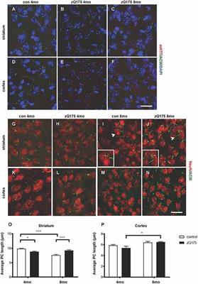 Targeted Depletion of Primary Cilia in Dopaminoceptive Neurons in a Preclinical Mouse Model of Huntington’s Disease